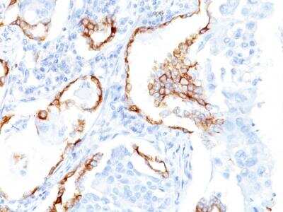 Immunohistochemistry-Paraffin: Cytokeratin 7 Antibody (K72.7) - IHC-Prediluted [NBP2-48125]