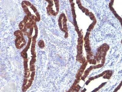 Immunohistochemistry-Paraffin: Cytokeratin 7 Antibody (K72.7) - IHC-Prediluted [NBP2-48125]