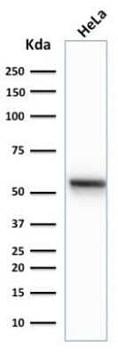 Western Blot: Cytokeratin 7 Antibody (K72.7) [NBP2-44816]