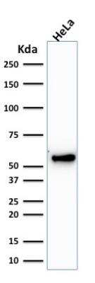 Western Blot: Cytokeratin 7 Antibody (KRT7/1198)Azide and BSA Free [NBP2-47944]