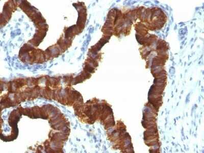 Immunohistochemistry-Paraffin: Cytokeratin 7 Antibody (KRT7/1198) - IHC-Prediluted [NBP2-48145]