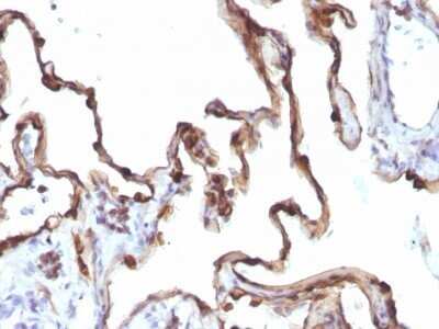 Immunohistochemistry-Paraffin: Cytokeratin 7 Antibody (KRT7/1198) - IHC-Prediluted [NBP2-48145]