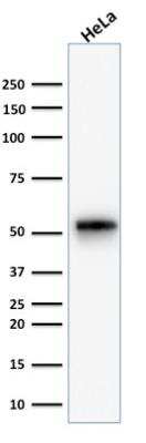 Western Blot: Cytokeratin 7 Antibody (KRT7/1499R)Azide and BSA Free [NBP2-49881]