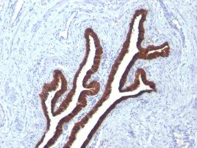 Immunohistochemistry-Paraffin: Cytokeratin 7 Antibody (KRT7/760 + KRT7/903) - Azide and BSA Free [NBP2-47942]