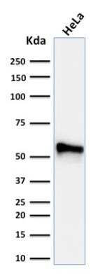 Western Blot: Cytokeratin 7 Antibody (KRT7/760 + KRT7/903)Azide and BSA Free [NBP2-47942]