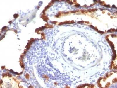 Immunohistochemistry-Paraffin: Cytokeratin 7 Antibody (KRT7/760 + KRT7/903) - IHC-Prediluted [NBP2-48143]