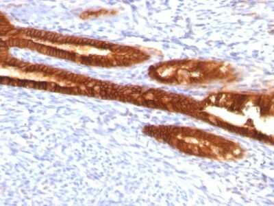 Immunohistochemistry-Paraffin: Cytokeratin 7 Antibody (KRT7/760 + KRT7/903) [NBP2-44818]