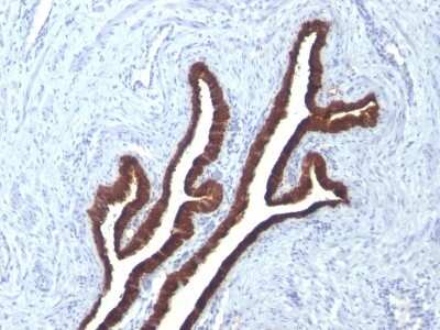 Immunohistochemistry-Paraffin: Cytokeratin 7 Antibody (KRT7/760 + KRT7/903) [NBP2-44818]
