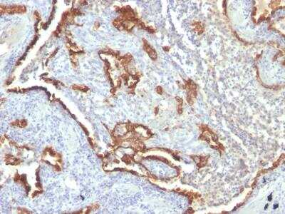 Immunohistochemistry-Paraffin: Cytokeratin 7 Antibody (KRT7/760 + OV-TL12/30) - Azide and BSA Free [NBP2-47943]