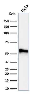 Western Blot: Cytokeratin 7 Antibody (KRT7/760 + OV-TL12/30)Azide and BSA Free [NBP2-47943]