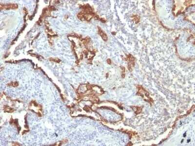 Immunohistochemistry-Paraffin: Cytokeratin 7 Antibody (KRT7/760 + OV-TL12/30) - IHC-Prediluted [NBP2-48144]