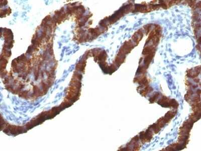 Immunohistochemistry-Paraffin: Cytokeratin 7 Antibody (KRT7/760 + OV-TL12/30) [NBP2-44819]