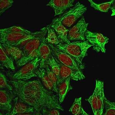 Immunocytochemistry/ Immunofluorescence: Cytokeratin 7 Antibody (KRT7/760) - Azide and BSA Free [NBP2-47939]