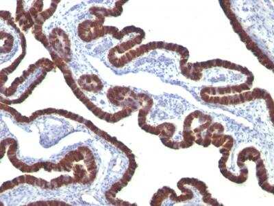 Immunohistochemistry-Paraffin: Cytokeratin 7 Antibody (KRT7/760) - Azide and BSA Free [NBP2-47939]