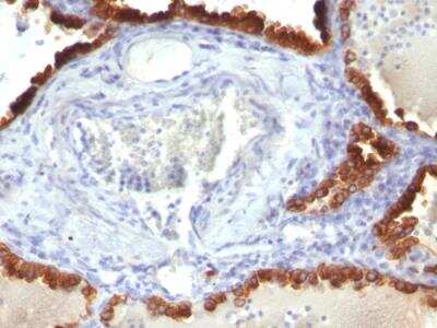 Immunohistochemistry-Paraffin: Cytokeratin 7 Antibody (KRT7/760) - Azide and BSA Free [NBP2-47939]