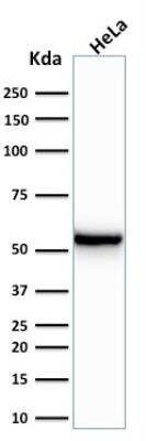 Western Blot: Cytokeratin 7 Antibody (KRT7/760)Azide and BSA Free [NBP2-47939]