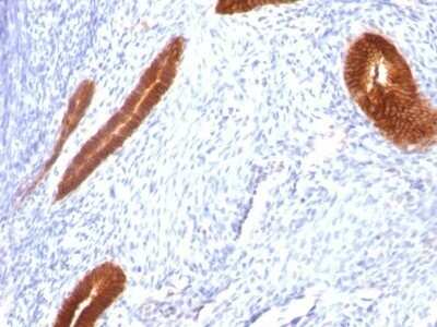 Immunohistochemistry-Paraffin: Cytokeratin 7 Antibody (KRT7/760) - IHC-Prediluted [NBP2-48140]