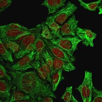 Immunocytochemistry/ Immunofluorescence: Cytokeratin 7 Antibody (KRT7/760) [NBP2-44813]