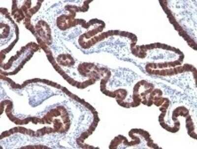Immunohistochemistry-Paraffin: Cytokeratin 7 Antibody (KRT7/760) [NBP2-44813]