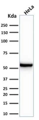 Western Blot: Cytokeratin 7 Antibody (KRT7/760) [NBP2-44813]