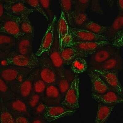 Immunocytochemistry/ Immunofluorescence: Cytokeratin 7 Antibody (KRT7/903) - Azide and BSA Free [NBP3-11426]