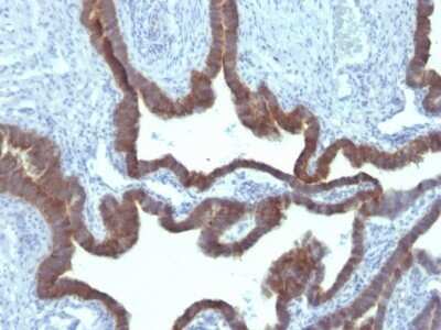 Immunohistochemistry-Paraffin: Cytokeratin 7 Antibody (KRT7/903) - IHC-Prediluted [NBP2-48139]