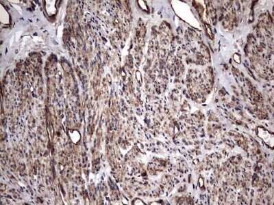 Immunohistochemistry: Cytokeratin 7 Antibody (OTI2A2) - Azide and BSA Free [NBP2-71080]