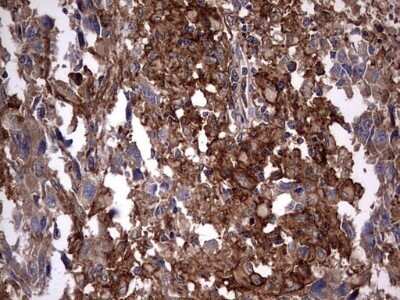 Immunohistochemistry: Cytokeratin 7 Antibody (OTI2A2) - Azide and BSA Free [NBP2-71080]