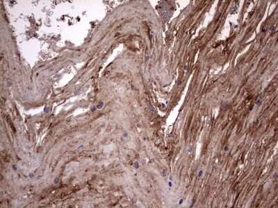 Immunohistochemistry: Cytokeratin 7 Antibody (OTI2A2) - Azide and BSA Free [NBP2-71080]