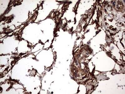 Immunohistochemistry: Cytokeratin 7 Antibody (OTI2A2) - Azide and BSA Free [NBP2-71080]