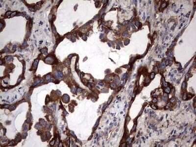 Immunohistochemistry: Cytokeratin 7 Antibody (OTI2A2) - Azide and BSA Free [NBP2-71080]