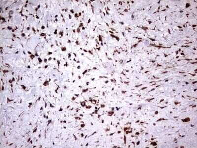 Immunohistochemistry: Cytokeratin 7 Antibody (OTI2A2) - Azide and BSA Free [NBP2-71080]