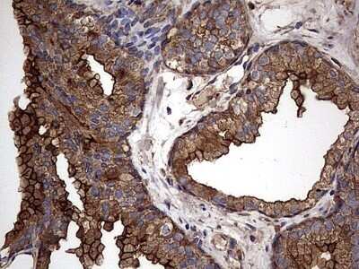 Immunohistochemistry: Cytokeratin 7 Antibody (OTI2A2) - Azide and BSA Free [NBP2-71080]