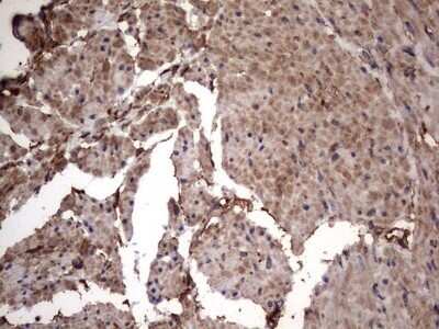 Immunohistochemistry: Cytokeratin 7 Antibody (OTI2A2) - Azide and BSA Free [NBP2-71080]