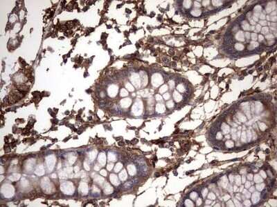 Immunohistochemistry: Cytokeratin 7 Antibody (OTI2A2) - Azide and BSA Free [NBP2-71080]