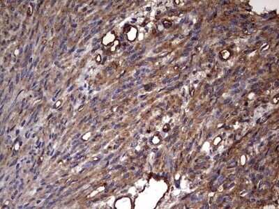 Immunohistochemistry: Cytokeratin 7 Antibody (OTI2A2) - Azide and BSA Free [NBP2-71080]