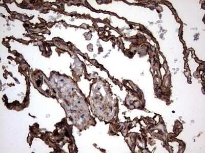 Immunohistochemistry: Cytokeratin 7 Antibody (OTI2A2) - Azide and BSA Free [NBP2-71080]