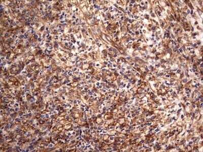 Immunohistochemistry: Cytokeratin 7 Antibody (OTI2A2) - Azide and BSA Free [NBP2-71080]