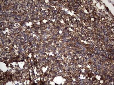 Immunohistochemistry: Cytokeratin 7 Antibody (OTI2A2) - Azide and BSA Free [NBP2-71080]