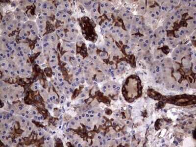Immunohistochemistry: Cytokeratin 7 Antibody (OTI2A2) - Azide and BSA Free [NBP2-71080]
