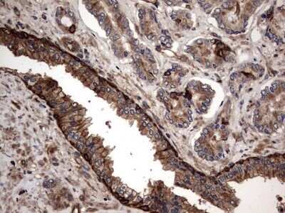 Immunohistochemistry: Cytokeratin 7 Antibody (OTI2A2) - Azide and BSA Free [NBP2-71080]