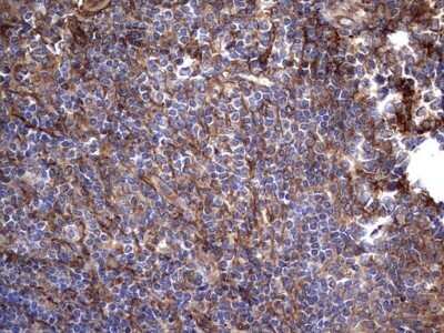 Immunohistochemistry: Cytokeratin 7 Antibody (OTI2A2) - Azide and BSA Free [NBP2-71080]