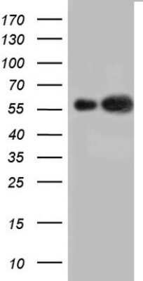 Western Blot: Cytokeratin 7 Antibody (OTI2A2)Azide and BSA Free [NBP2-71080]