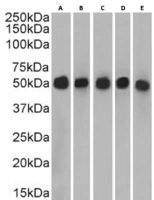 Western Blot: Cytokeratin 7 Antibody (OV-TL 12/30)ChimericAzide and BSA Free [NBP3-12014]