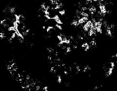 Immunocytochemistry/ Immunofluorescence: Cytokeratin 7 Antibody (OV-TL12/30) - Azide and BSA Free [NBP2-47940]