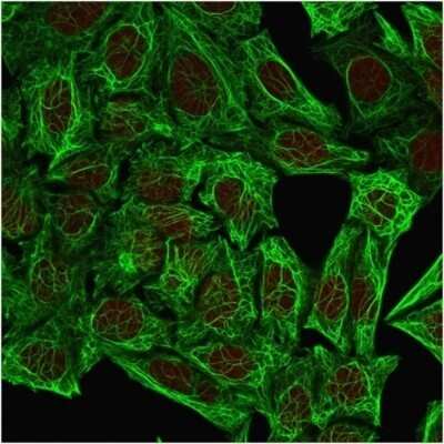 Immunocytochemistry/ Immunofluorescence: Cytokeratin 7 Antibody (OV-TL12/30) - Azide and BSA Free [NBP2-47940]