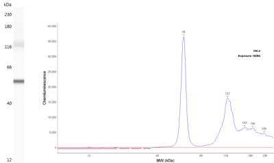 Simple Western: Cytokeratin 7 Antibody (OV-TL12/30)Azide and BSA Free [NBP2-47940]
