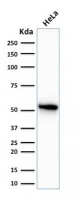 Western Blot: Cytokeratin 7 Antibody (OV-TL12/30)Azide and BSA Free [NBP2-47940]