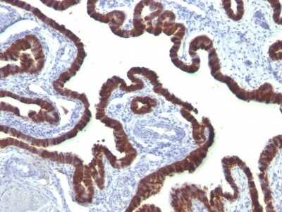 Immunohistochemistry-Paraffin: Cytokeratin 7 Antibody (OV-TL12/30) [NBP2-44814]