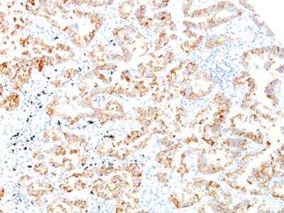 Immunohistochemistry-Paraffin: Cytokeratin 7 Antibody (SPM270) - IHC-Prediluted [NBP2-48124]